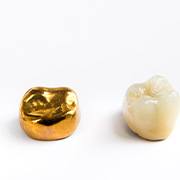 The cost of your dental crown may be influenced by the material used to create it