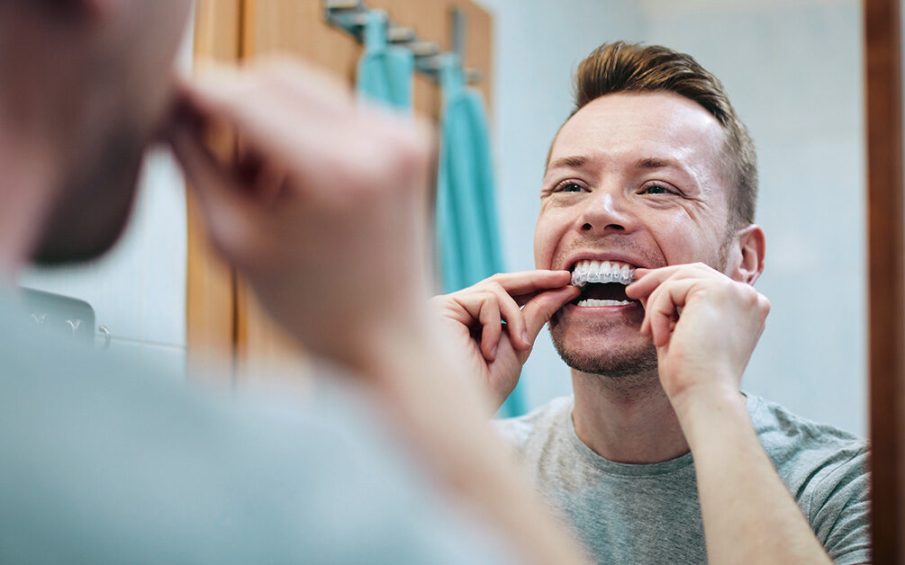 person using store-bought teeth whitening products 