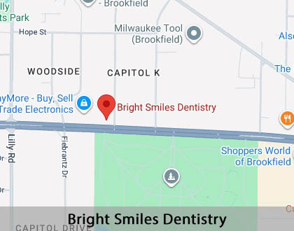 Map image for Multiple Teeth Replacement Options in Brookfield, WI